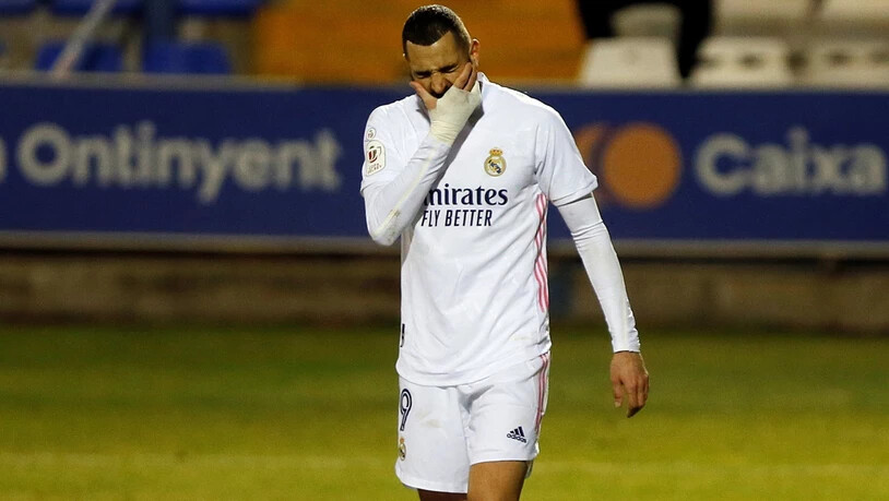 Real Madrid (hier Karim Benzema) blamierte sich gegen einen Drittligisten