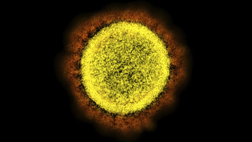 ARCHIV - Eine elektronenmikroskopische Aufnahme zeigt ein von einem Patienten isoliertes Partikel des Coronavirus SARS-CoV-2 in einem Labor. Foto: NIAID/NIH/AP/dpa - ACHTUNG: Nur zur redaktionellen Verwendung und nur mit vollständiger Nennung des…