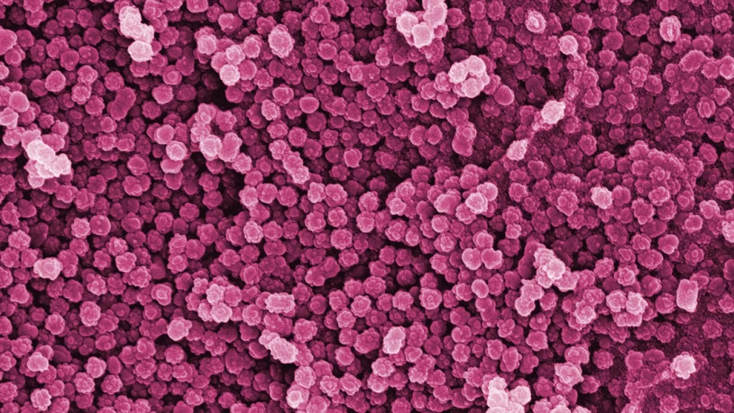 Nanopartikel in 150'000-facher Vergrösserung: Sie sind unsichtbar für das blosse Auge, in der Umwelt wohl aber weit verbreitet. Noch bestehen grosse Wissenslücken zu den winzigen Teilchen. (Pressebild)