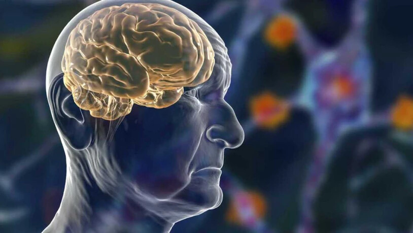 Die Parkinson-Krankheit ist eine neurodegenerative Erkrankung, die das Nervensystem des Menschen angreift.