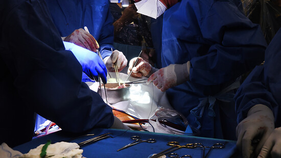 Ärzte operieren an einem Schweineherz, das in einen menschlichen Patienten eingesetzt wird. Foto: Tom Jemski/University of Maryland School of Medicine/dpa