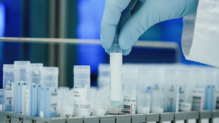 ARCHIV - Ein Mitarbeiter hält in einem Coronatest-Labor PCR-Teströhrchen in den Händen. Foto: Uwe Anspach/dpa