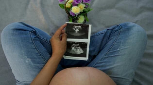 Schwangerschaft: Die Ultraschallbilder dokumentieren die Entwicklung des Babys. 
